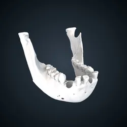 Pongo pygmaeus: mandible