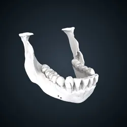 Pongo pygmaeus: mandible