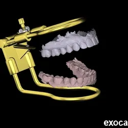 Harman Occludator – Dental Occlusion Reference Tool - EXOCAD