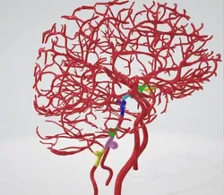 3D Collection: 7 Common sites of cerebral vascular aneurysms within circle of Willis, Anterior Communicating, Middle Cerebral, Basilar, Anterior and Posterior Inferior Cerebellar Artery