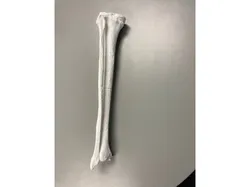 Tibia and Fibia split into 2 Parts
