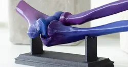Elbow Joint from CT-Scan