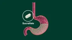 Mucosal Protectants