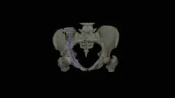 Pelvis Segmentation