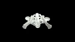 Pelvic Segmentation