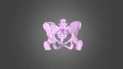 Pelvix Segmentation