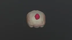 Brain Tumor Segmentation