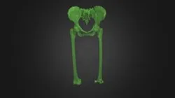 CTFemur Segmentation