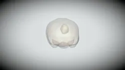 Tumors Project