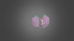 CTACardio Segmentations