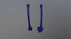 Femur Segmentation