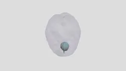 Tumor Modelssegmentation