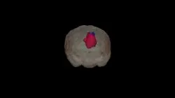Tumor Segementation