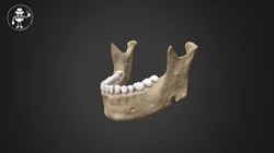 Ballistic Trauma (Gunshot Trauma)