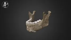 Post-mortem trauma