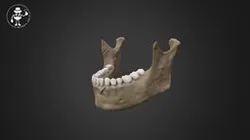 Sharp Force Trauma