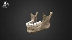 Anatomical points and landmarks