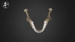 Mandibular Permanent teeth