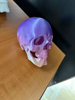 Skull