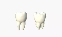 Tooth Molar 3D model