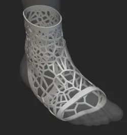 Patient-Specific Lattice Orthotic Brace (FEA-Driven Design)