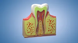 Medical Teeth Dental profile cortical structure of the gums neurovasculature Teeth