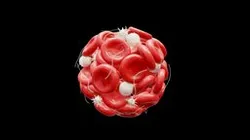 Blood Clot Thrombus