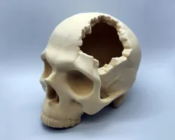 Major Headache Skull