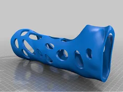 Large Arm Cast