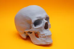 Skull from CT Scan