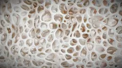 Bone Tissue Structure