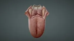 Tongue Anatomy (Dorsum of tongue)