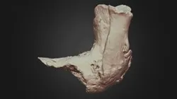 Ursus americanus (Black Bear) Fracture