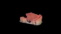 Teeth (2) down