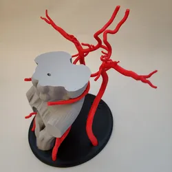 Circle of Willis/Arteries of the Brain