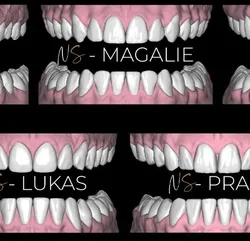 FREE EXOCAD Tooth Library George Zacusai Natural Shape Design Library