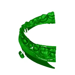Free Other STL Download - yyyby Dentkraft Dentkraft