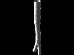 Aorta bifurcation
