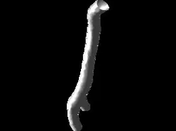Right Carotid Bifurcating Artery