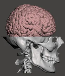 Brain in Skull with Neck