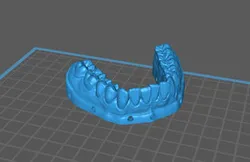 Teeth