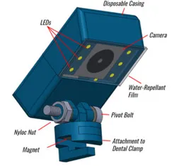 Toothpic: An Intraorally-Fixated Dental Camera that Aims to Prevent Musculoskeletal Pain in Dentists