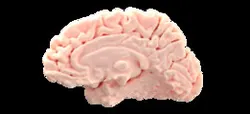 Brain - Right Hemisphere | TRINOTA