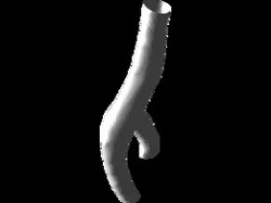 Carotid Bifurcation Model