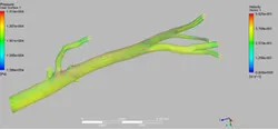 Human Aorta Simulation