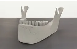 HUMAN JAW