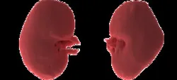 Kidneys from CAT Scan | TRINOTA