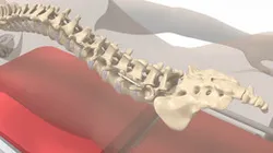 Spine Fixator