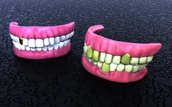 TEETH %%