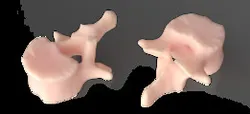 Vertebra from CAT Scan | TRINOTA